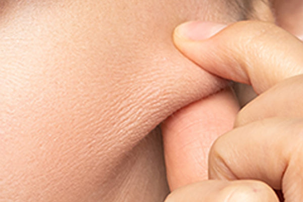 La perte d’élasticité de la peau est un des signes du vieillissement cutané.