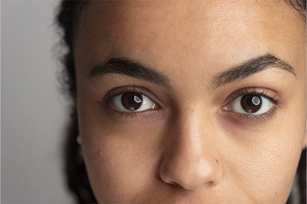 Comment enlever les différents types de cernes sous les yeux