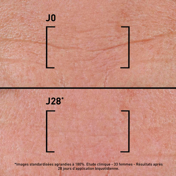 Visuel avant et après utilisation de TIME FILLER INTENSIVE 5XP
