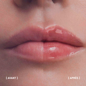 Visuel avant-après de HYALU-FILLER LIPS