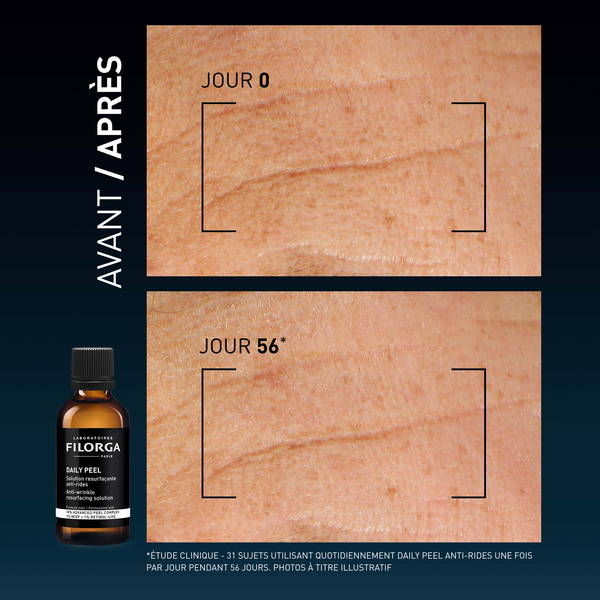 Visuel before/after DAILY-PEEL WRINKLE