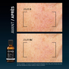 Visuel before/after DAILY PEEL ANTI-TACHES