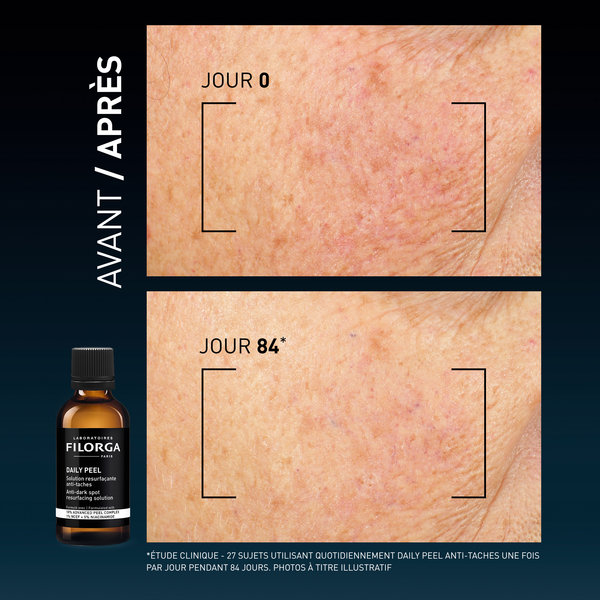 Visuel before/after DAILY PEEL ANTI-TACHES