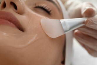 Le peeling visage en médecine esthétique permet de faire peau neuve